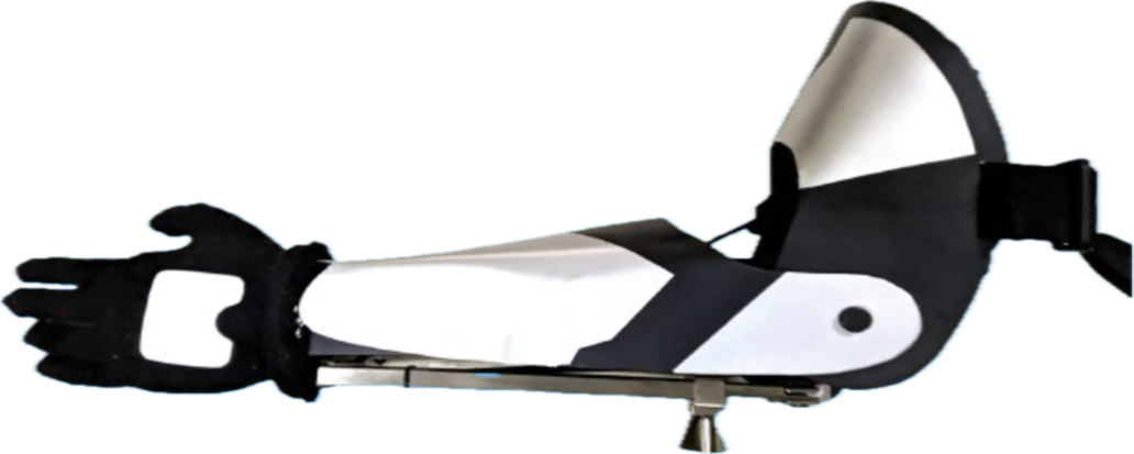 Karla Bionics Prosthetic Arm